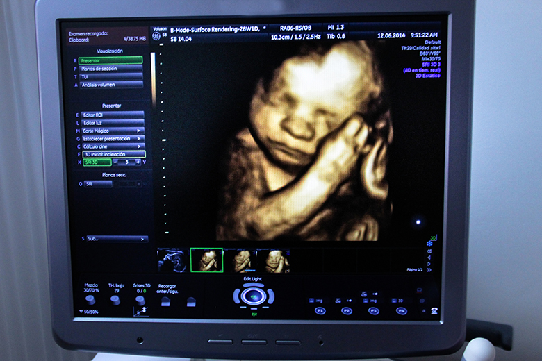 Monitor Doppler Ultrasonido Latidos Del Bebe Embarazo Fetal
