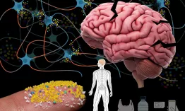 El estudio muestra una asociación entre altos niveles de microplásticos en el cerebro y el diagnóstico de demencia.