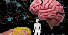 El estudio muestra una asociación entre altos niveles de microplásticos en el cerebro y el diagnóstico de demencia.