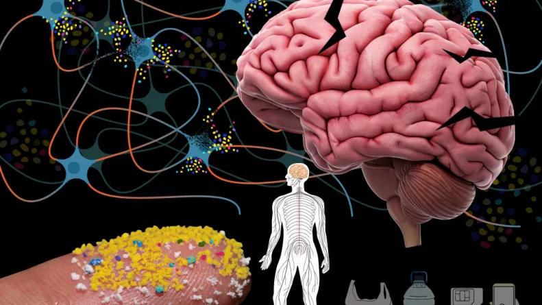 El estudio muestra una asociación entre altos niveles de microplásticos en el cerebro y el diagnóstico de demencia.