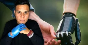 Su iniciativa LAT Bionics ha brindado autonomía a más de 100 personas y simboliza cómo la ingeniería puede generar oportunidades reales de cambio. Foto: Stakeholders.