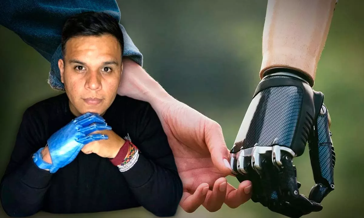 Su iniciativa LAT Bionics ha brindado autonomía a más de 100 personas y simboliza cómo la ingeniería puede generar oportunidades reales de cambio. Foto: Stakeholders.