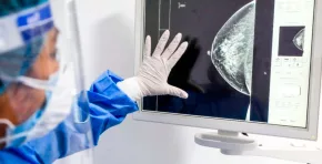 Especialistas advierten que solo una fracción mínima de las células malignas sobrevive al viaje por el cuerpo, pero su capacidad de adaptación las convierte en el mayor desafío del cáncer moderno.