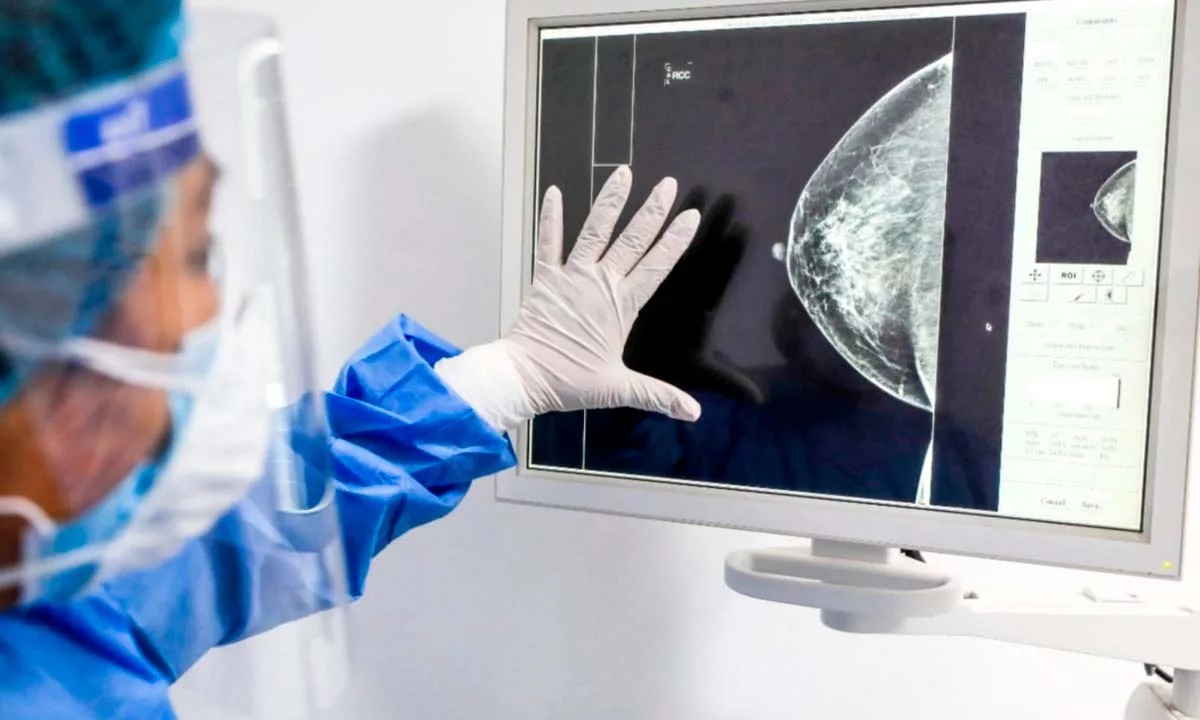 Especialistas advierten que solo una fracción mínima de las células malignas sobrevive al viaje por el cuerpo, pero su capacidad de adaptación las convierte en el mayor desafío del cáncer moderno.